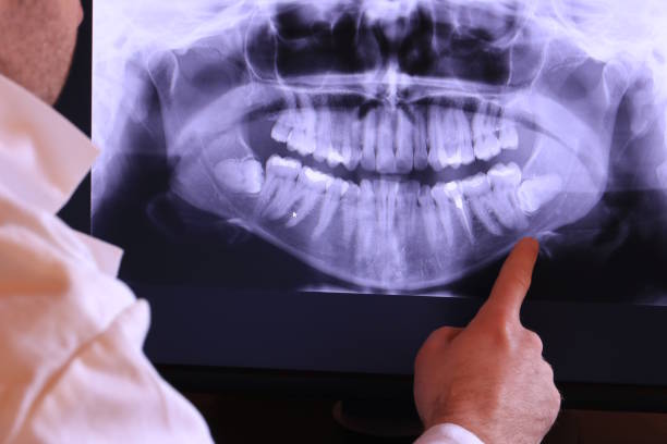 Best Broken or Cracked Tooth Emergency Dentist in Ester, AK