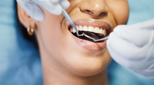 Best Emergency Root Canal Treatment in Ester, AK