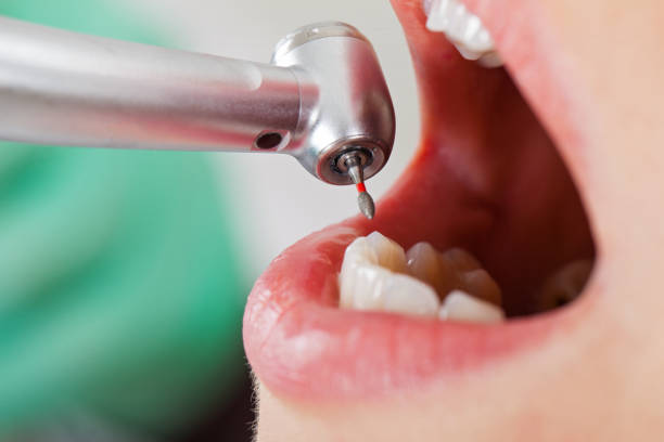 Best Broken or Cracked Tooth Emergency Dentist in Ester, AK